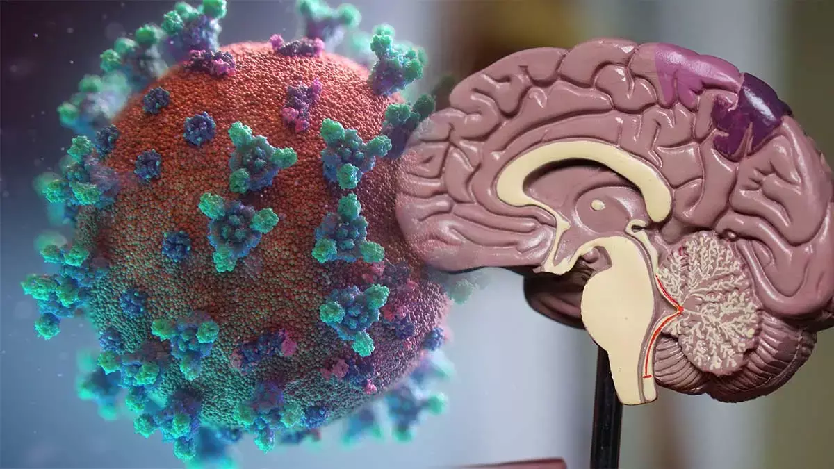 La covid tiene efectos en el cerebro