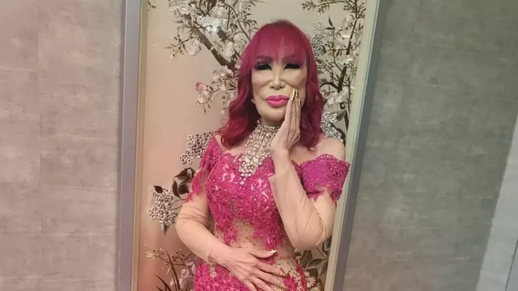 Así era Lyn May antes de las cirugías