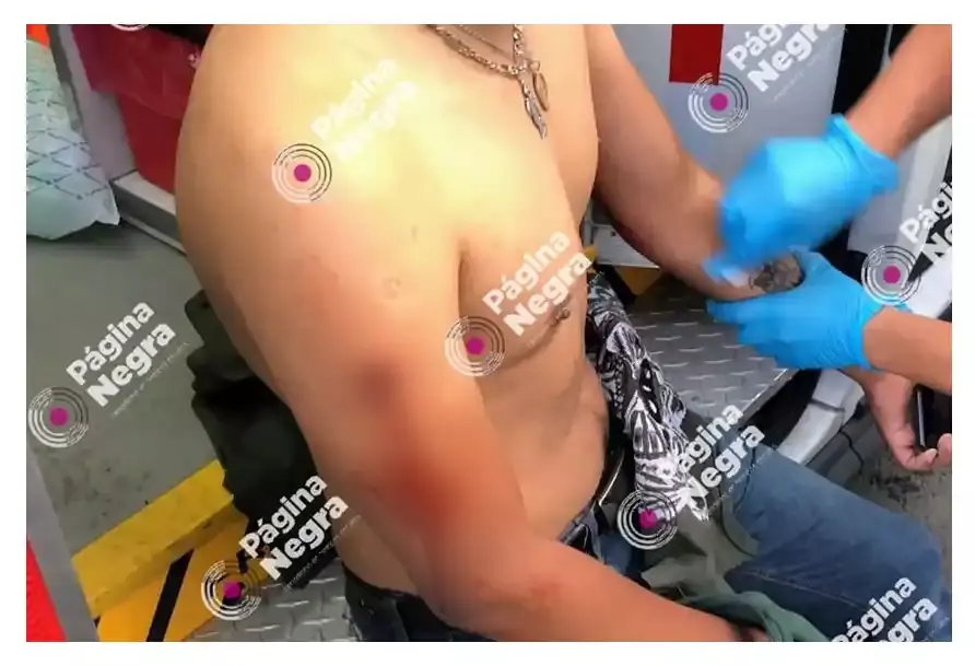 Motociclista es baleado en bulevar Clavijero; querían asaltarlo.
