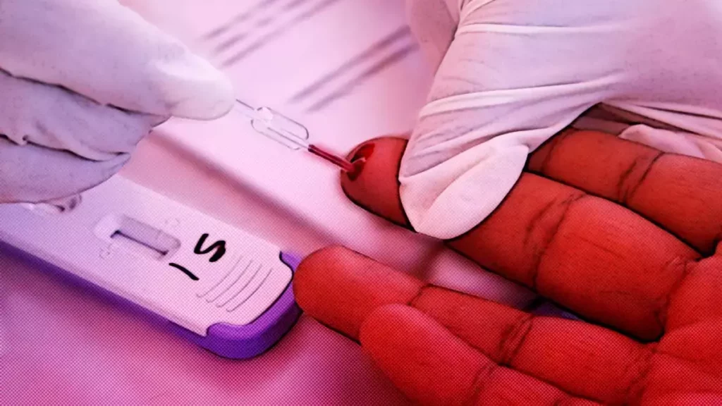 Casos de VIH en Puebla aumentaron un 152% en el segundo trimestre de 2022