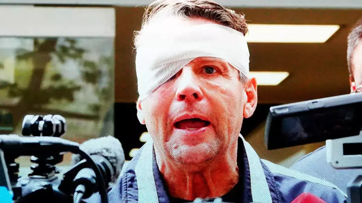 Alfredo Adame casi pierde el ojo derecho… esta es la historia