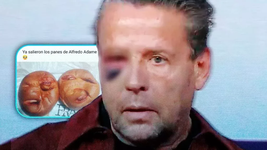 Lanzan pan de Alfredo Adame: con la cara torcida y el ojo morado