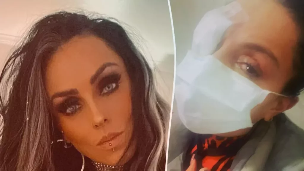 ¿Ivonne Montero se quedará ciega? Esto es lo que reveló