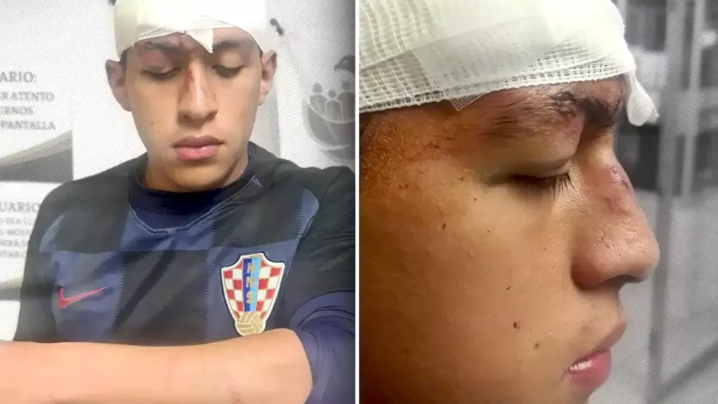 Por lesiones, denuncian al hijo de la directora de Comunicación Social de Puebla.