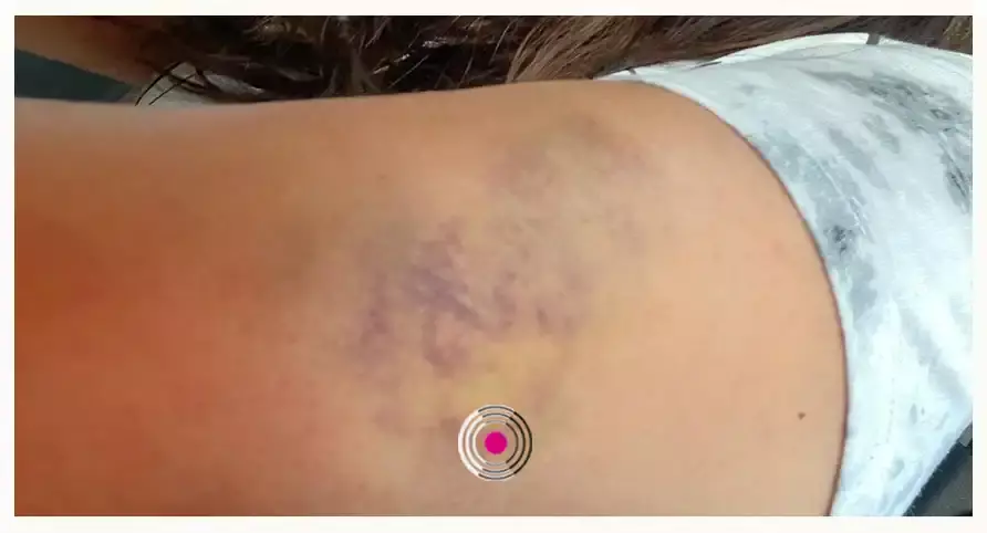 Trabajadores de Axxwel golpean a clientes por negarse a dar propina del 20%