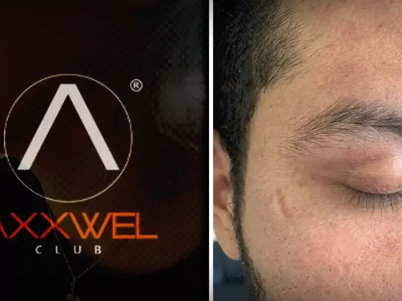 Trabajadores de Axxwel golpean a clientes por negarse a dar propina del 20%
