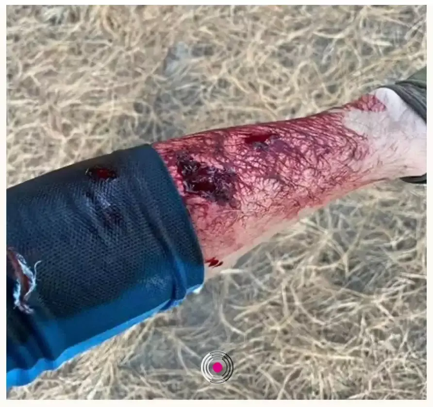 Perro ataca a deportistas en el cerro Zapotecas; dueño lo saca sin correa.