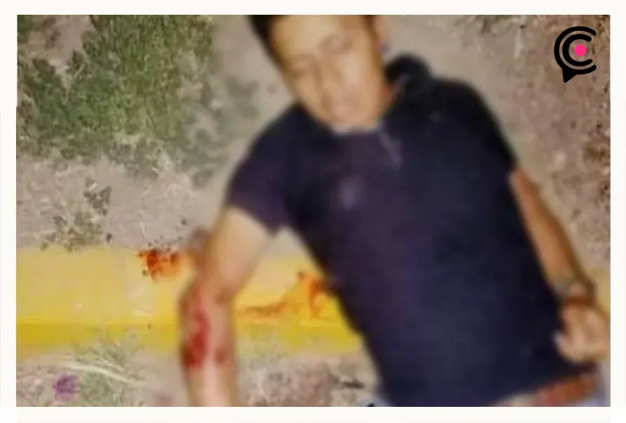 De varios disparos asesinaron a joven en Cholula; fue un ataque directo.