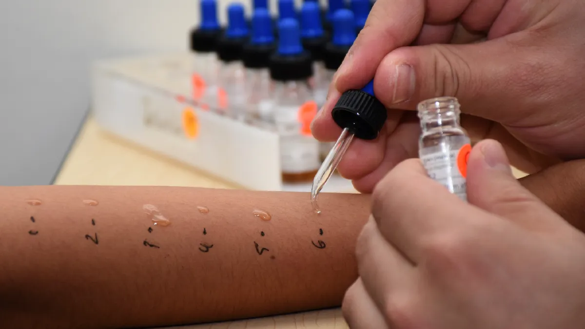 El Servicio de Alergia e Inmunología Clínica del HUP realiza estudios sobre sensibilidad de vacunas contra SARS-CoV-2 en pacientes con alergia