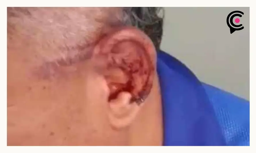 Asaltan y golpean a sonidero en Xonacatepec