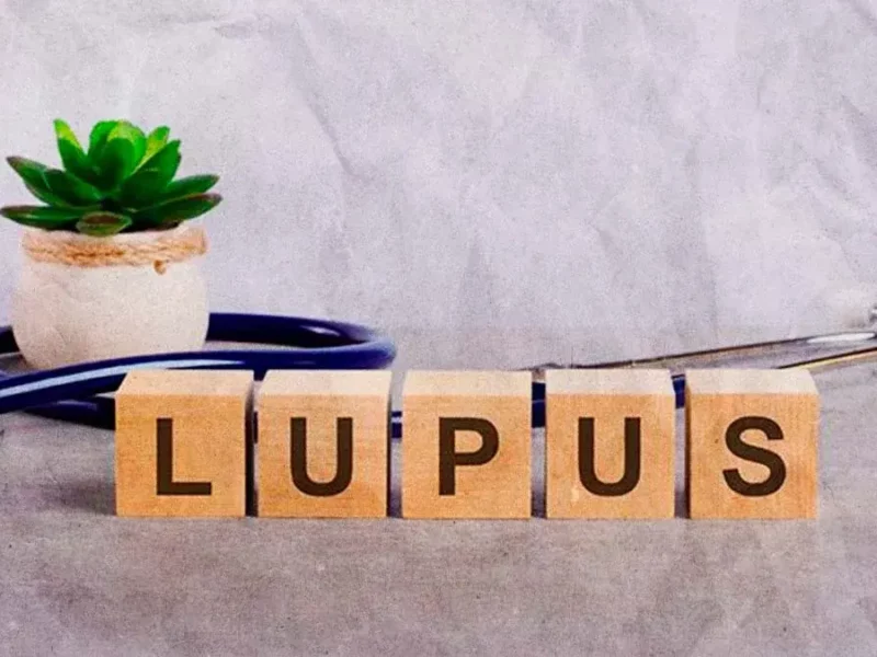 Por primera vez, Puebla tendrá una caminata por los Derechos de las personas con Lupus 