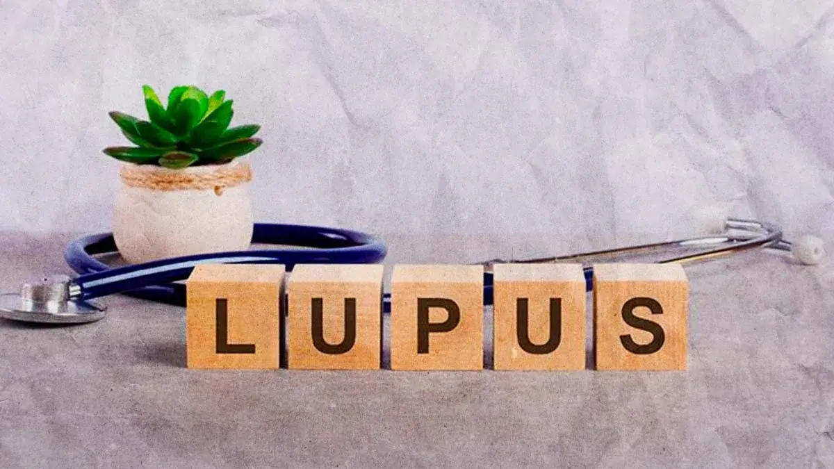 Por primera vez, Puebla tendrá una caminata por los Derechos de las personas con Lupus 