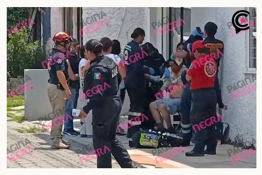 Hombre sufrió quemaduras de segundo grado, tras incendiarse su casa en Puebla