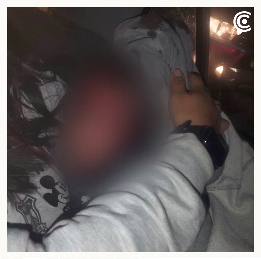 Balean niña durante operativo en el Mercado Independencia, acusan a policía municipal de Puebla 