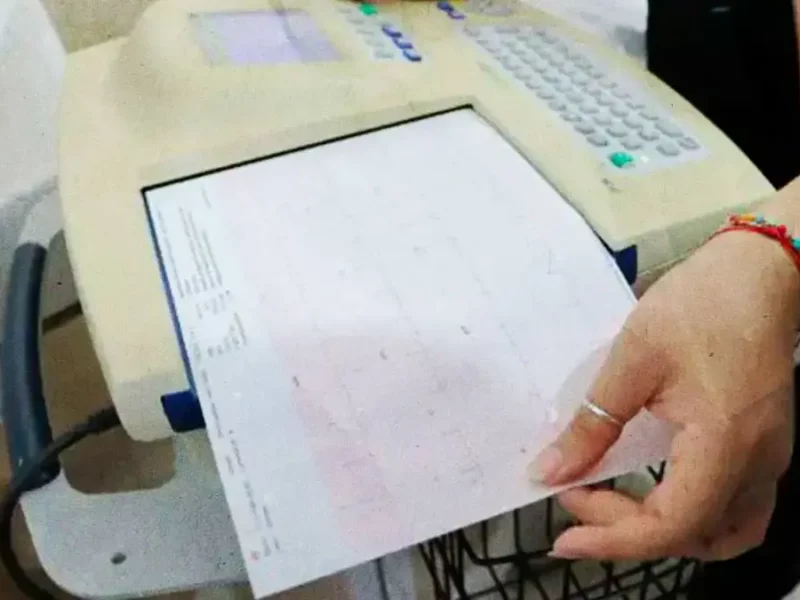 SMDIF de Puebla invita a realizarse estudio de electrocardiograma