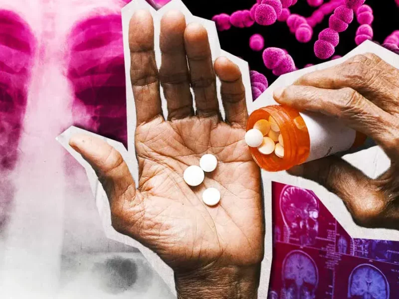 Estas fueron las causas medicas más raras atendidas por Salud en Puebla durante 2024 