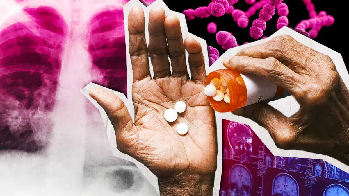 Estas fueron las causas medicas más raras atendidas por Salud en Puebla durante 2024 