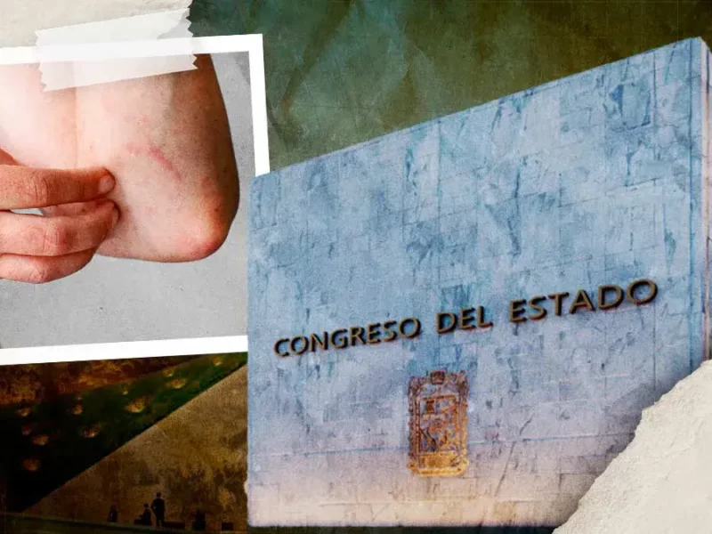 Congreso de Puebla propone "Ley Lupus" para garantizar atención y tratamiento a pacientes con enfermedades autoinmunes