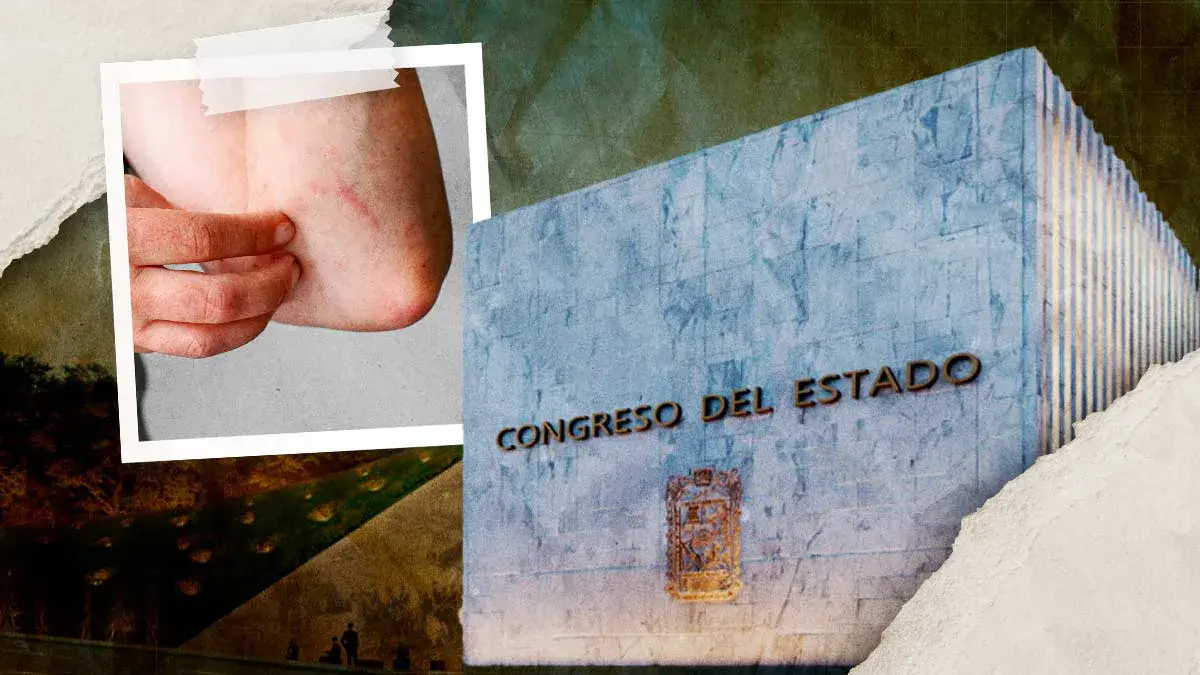 Congreso de Puebla propone "Ley Lupus" para garantizar atención y tratamiento a pacientes con enfermedades autoinmunes