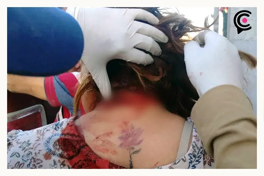 Presidente auxiliar de Los Reyes de Juárez golpea y ataca a machetazos a una mujer 