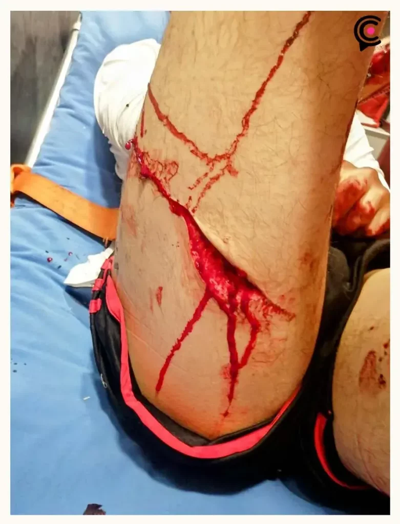 Pelea en partido de fútbol en Club Alpha 2 de Puebla deja un joven apuñalado
