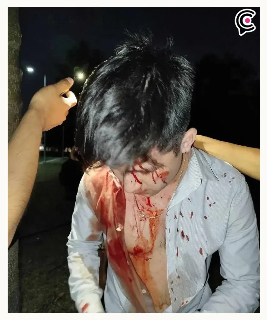 Apuñalan a estudiante dentro del Parque Ecológico, Puebla; agresor les robó sus identificaciones y pertenencias