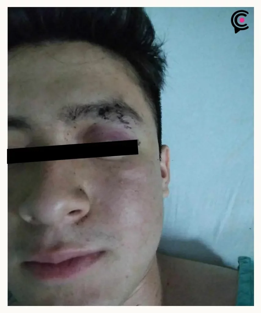 Apuñalan a estudiante dentro del Parque Ecológico, Puebla; agresor les robó sus identificaciones y pertenencias