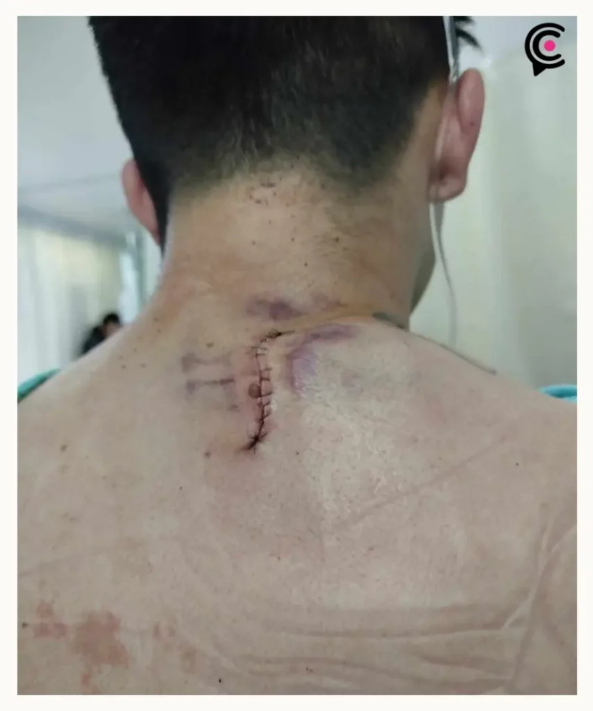 Apuñalan a estudiante dentro del Parque Ecológico, Puebla; agresor les robó sus identificaciones y pertenencias