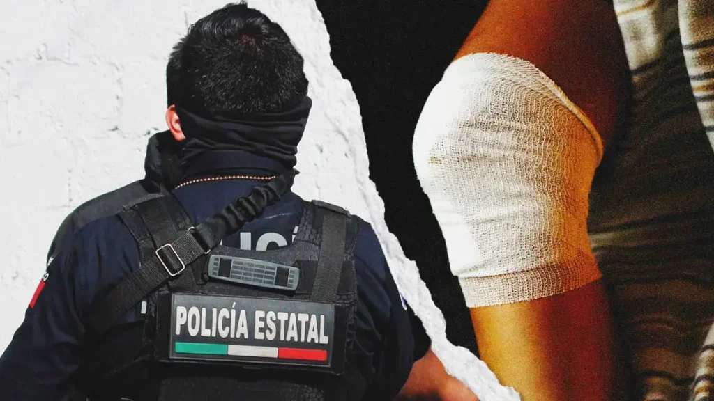 Policía estatal se disparó accidentalmente en la pierna con su arma en Los Fuertes, Puebla