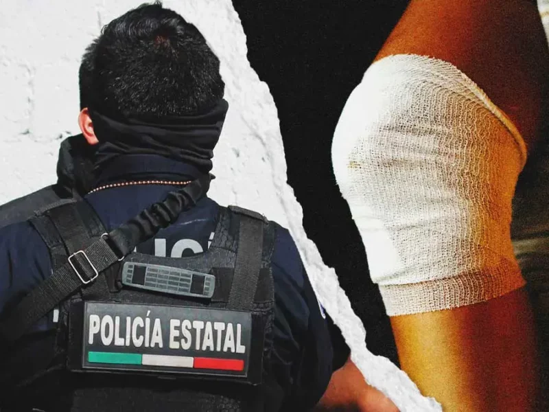 Policía estatal se disparó accidentalmente en la pierna con su arma en Los Fuertes, Puebla