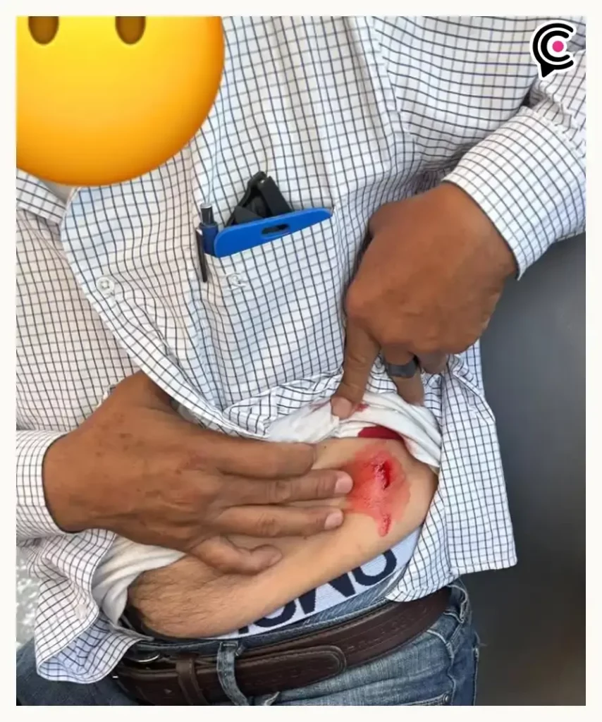 Adulto mayor acosa a joven, apuñala a hombre y ostenta historial de maltrato animal en Puebla