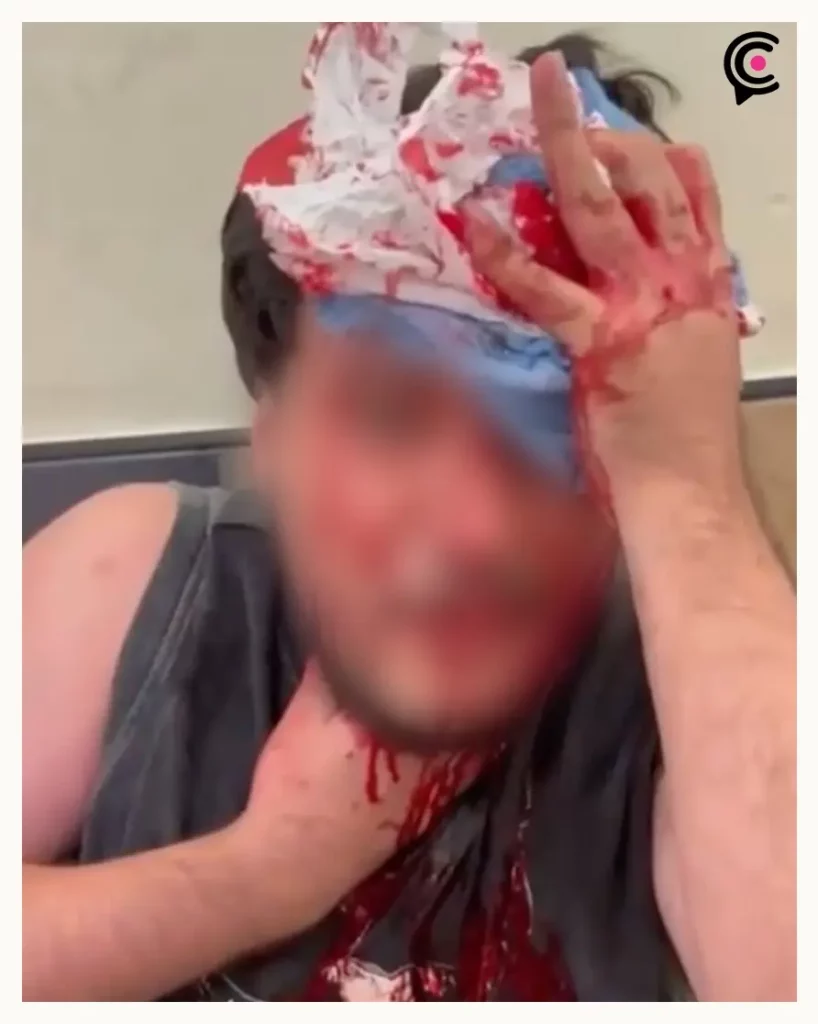 Atacan a joven LGBT+ en Taquería La Oriental de Puebla; activistas señalan crimen de odio