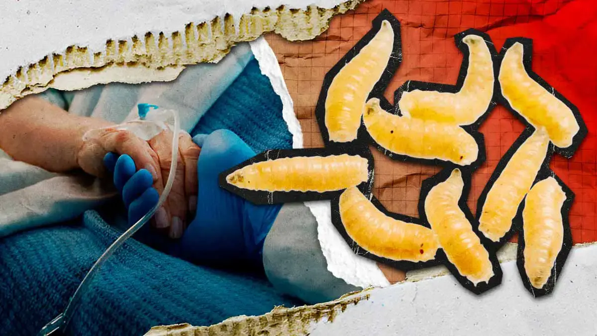 Muere mujer con cáncer tras infección del gusano barrenador; primer caso fatal en México