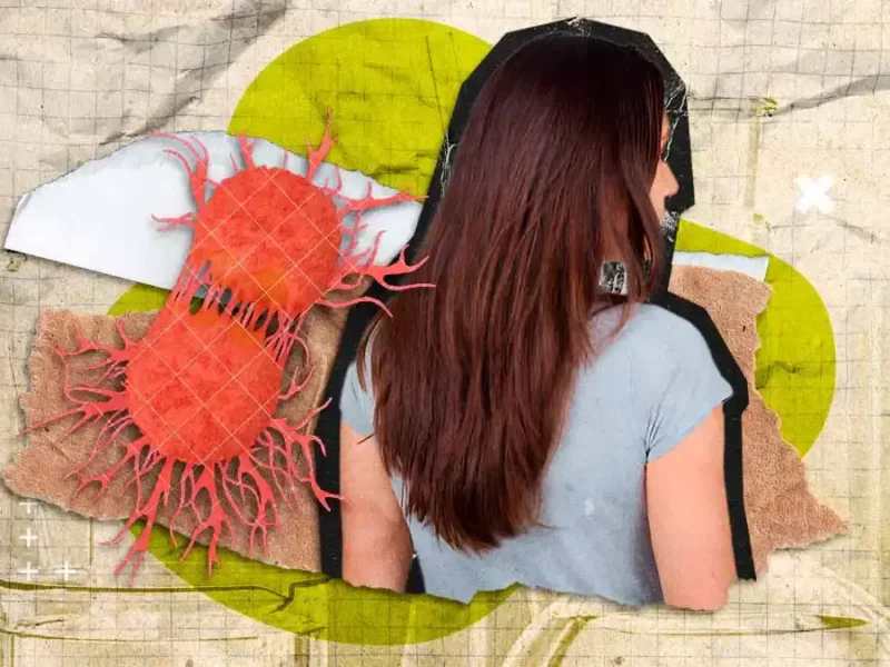 En ocho meses, diagnostican a mil 171 poblanos con tumores malignos; 74% son mujeres