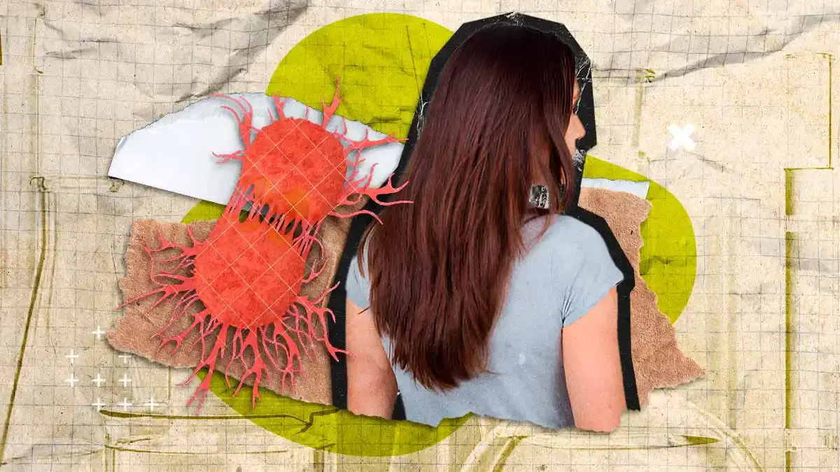 En ocho meses, diagnostican a mil 171 poblanos con tumores malignos; 74% son mujeres