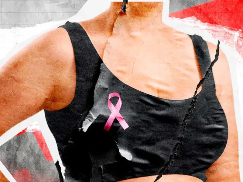 Mortalidad por cáncer de mama en Puebla creció 203% durante los últimos 14 años
