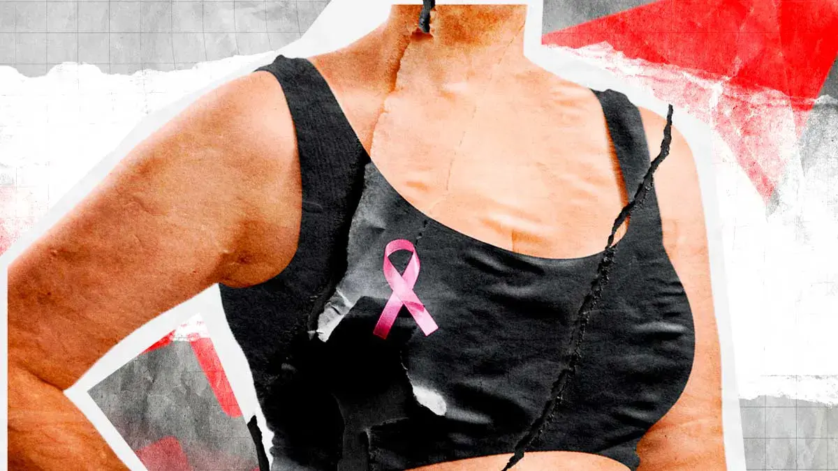 Mortalidad por cáncer de mama en Puebla creció 203% durante los últimos 14 años