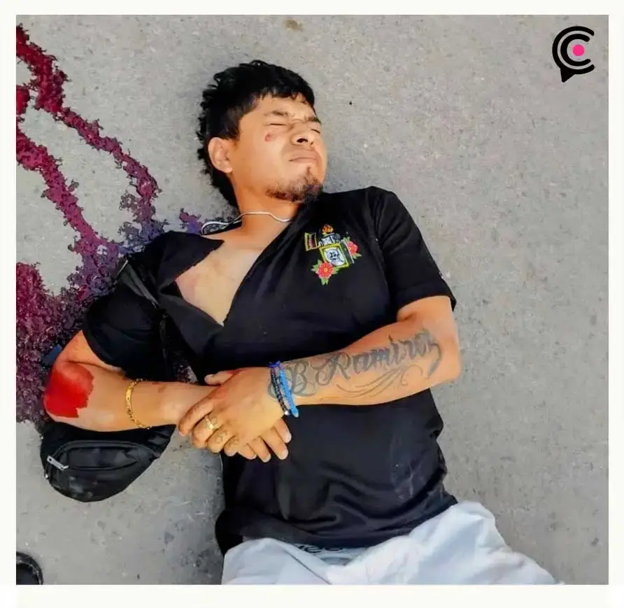 Asaltan y balean a motociclista en San Isidro Castillotla, Puebla