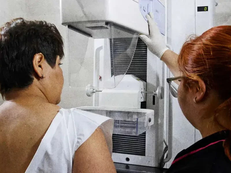 Club Rotario y Cáritas Puebla donarán 250 mastografías gratuitas a mujeres en situación vulnerable