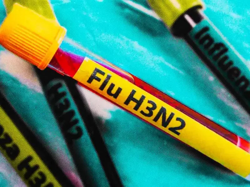 Gripe H3N2 desencadena afecciones en senos, oídos y neumonía; avanza en Europa y EE.UU