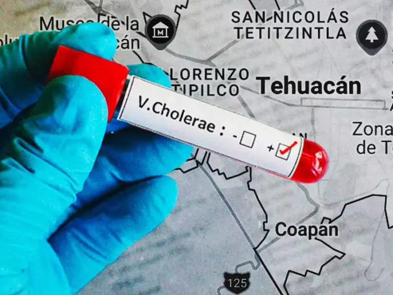 Detectan caso de cólera en Tehuacán, Puebla; primer reporte en México desde 2019