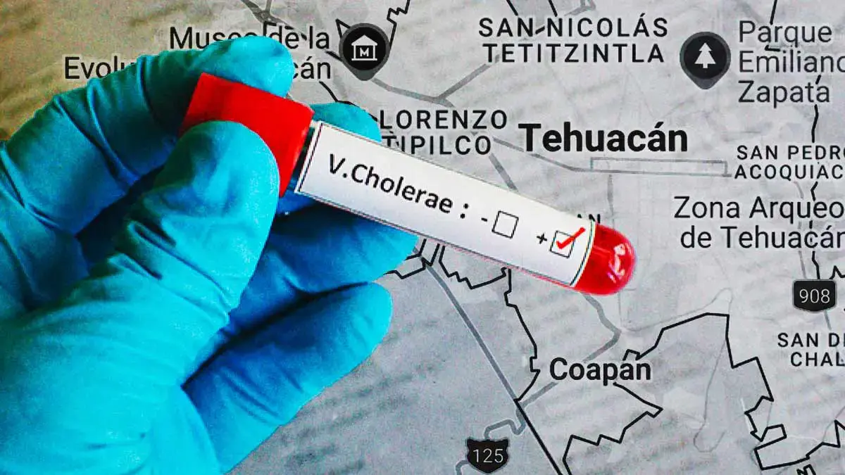 Detectan caso de cólera en Tehuacán, Puebla; primer reporte en México desde 2019