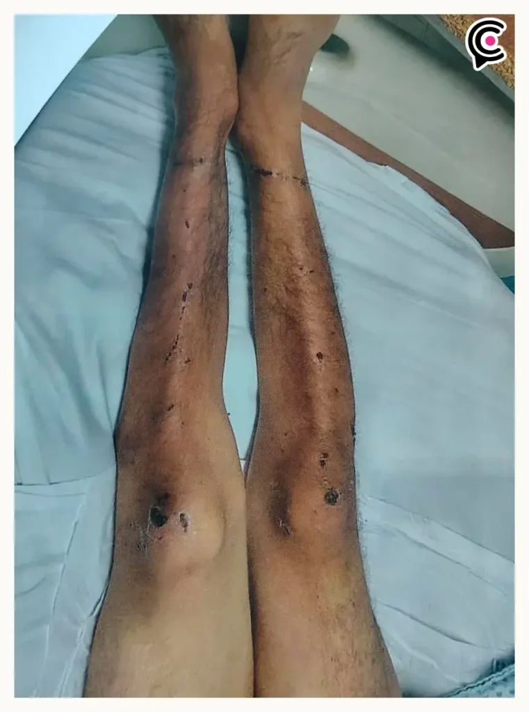 Reo agoniza golpiza en penal de San Miguel, Puebla; familia acusa fallas de control interno