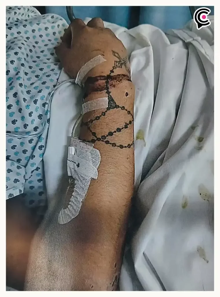 Reo agoniza golpiza en penal de San Miguel, Puebla; familia acusa fallas de control interno