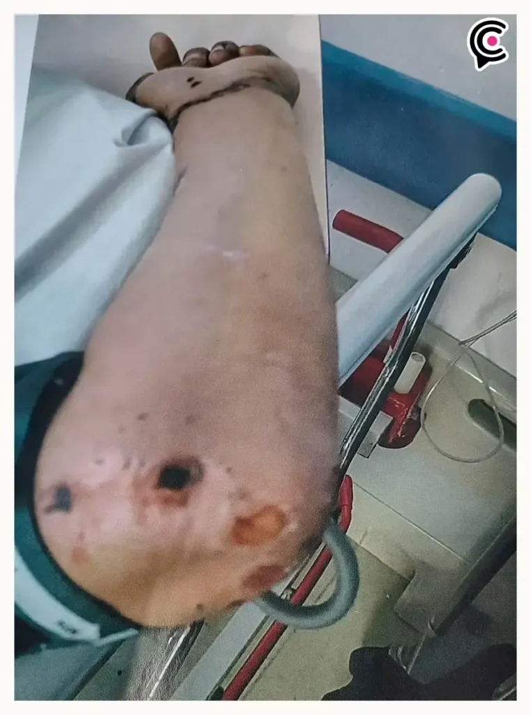 Reo agoniza golpiza en penal de San Miguel, Puebla; familia acusa fallas de control interno