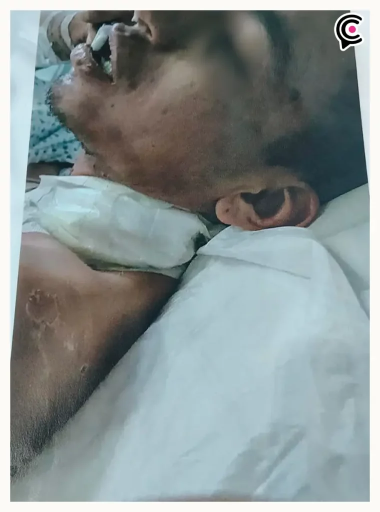 Reo agoniza golpiza en penal de San Miguel, Puebla; familia acusa fallas de control interno