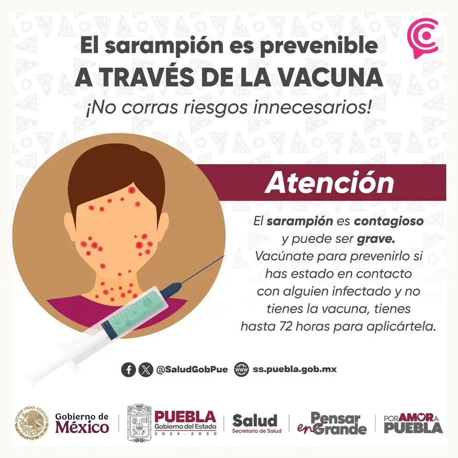 Gobierno de Puebla confirma el primer caso de sarampión en el estado
