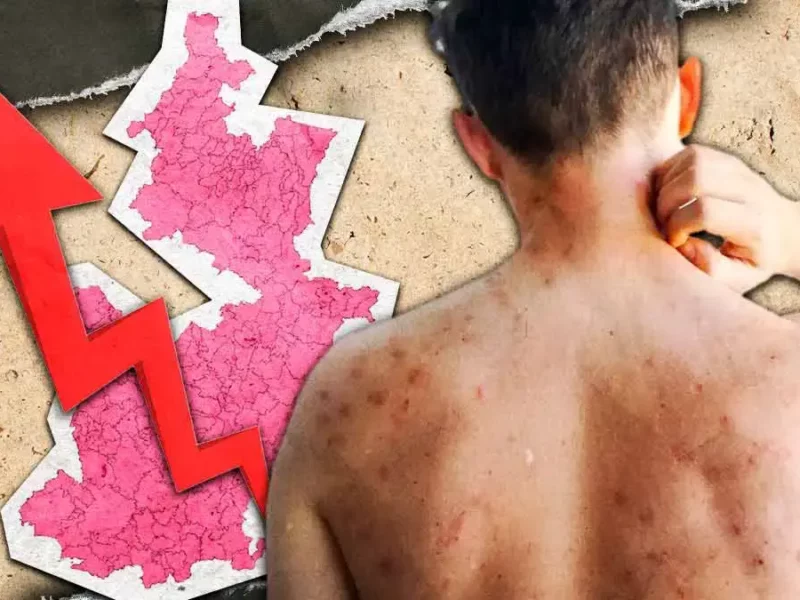 Suben a 53 los contagios confirmados de sarampión en Puebla en menos de 24 horas