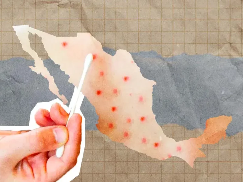 Brote de sarampión en México deja 28 muertes y nueve mil contagios confirmados en 2025-2026 
