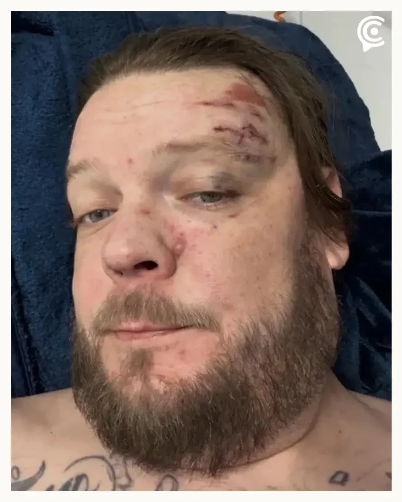 Corey Harrison de “El precio de la historia” accidentado en México; pide donaciones para tratamiento médico